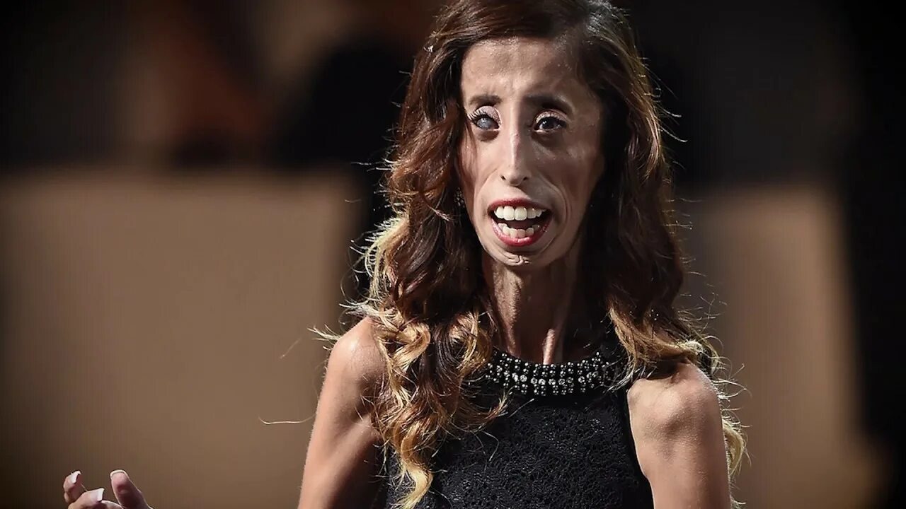 The Incredible Story Of The World s Ugliest Girl Lets No One Remain 